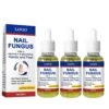 1-3pcs Fungal Nail Treatment Highly Effective Kill Nail Fungus For Best Result 3pcs