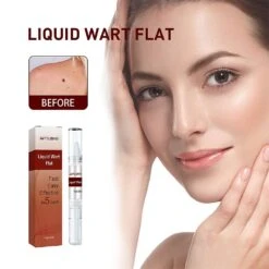 Skin Tags&moles Warts Corn Remover,tag Removal Skin Treatment Pen Face Care Mole Remover Wart Remover 3pcs 8 Skin Tags&moles Warts Corn Remover,tag Removal Skin Treatment Pen Face Care Mole Remover Wart Remover 3pcs -Cosmetics Promotion Store 1129682120 max