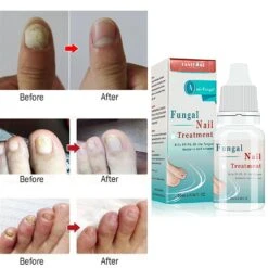 3x 10ml Fungal Nail Treatment Liquid Highly Effective Kills Toe Nail Fungus -Cosmetics Promotion Store 1145746364 max