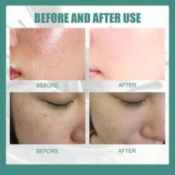 Goat Milk Silk Soap Acne Removing And Skin Cleansing Soap Bar Silk Protein Skin Repair Moisturizings Mite Removal -Cosmetics Promotion Store 1178827427 max