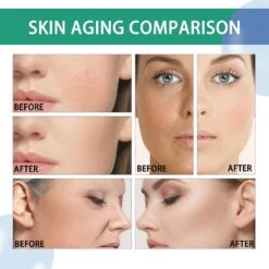 Nicotinamide B3 Essence Brightening Liquid 30ml, Moisturizing Ceramide Facial Essence 20231120 -Cosmetics Promotion Store 1197372057 max