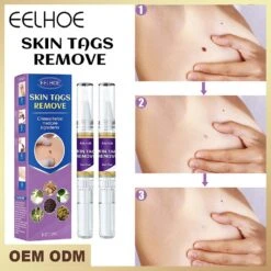 12 Hours Wart Remover Pen Skin Tag Mole Remover Eliminate Foot Corn Warts 1pc -Cosmetics Promotion Store 1239992920 max