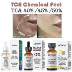 50% Tca Serum Skin Peeling 7-15 Day Delivered Skin Superforce Peeling Pigmentation TCA Peel 45 -Cosmetics Promotion Store 1273286717 max