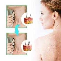 SmoothSkin Wart Eliminator Soap Natural Aloe Vera SoapInstant Blemish Removal 2pcs -Cosmetics Promotion Store 1298198896 max