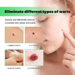 SmoothSkin Wart Eliminator Soap Natural Aloe Vera SoapInstant Blemish Removal 2pcs -Cosmetics Promotion Store 1298198897 max