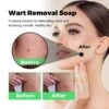 SmoothSkin Wart Eliminator Soap Natural Aloe Vera SoapInstant Blemish Removal 2pcs