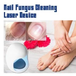 1-3pcs Nail Fungus Laser Treatment Device Repair Toenail Fingernail Fungus Treat Onychomycosis Therapy Cure Machine Effectively Remove 1pc -Cosmetics Promotion Store 1298391371 max 1