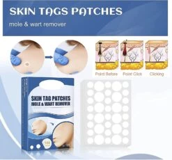 Fast Skin Tag Removal Patch,skin Tag Treatment Patch,skin Label Removal,fast Skin Tag Removal Patch,wart Removal Sticker -Cosmetics Promotion Store 1312220184 max