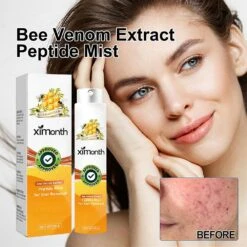 Scar Removal Spray Medical Grade Smoothing For Pregnancy Surgical Scars Burn -Cosmetics Promotion Store 1312833940 max 1