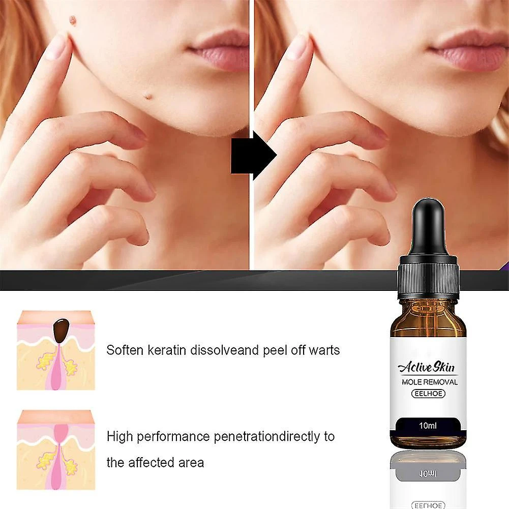 Fast Skin Tag Remover Serum Natural Treatment Moles Warts & Tags 1 Fast Skin Tag Remover Serum Natural Treatment Moles Warts & Tags