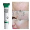 20ml Salicylic Acid Pores Refining Cream Shrink Pore Improve Acnes Blackheads Whitening Cream Anti-aging Oil Control Skin Care