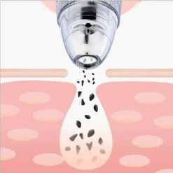 USB Blackhead Remover Electric Vacuum Acne Pimple Black Spot Suction Facial Pore Cleaner Skincare Exfoliating Beauty Instrument