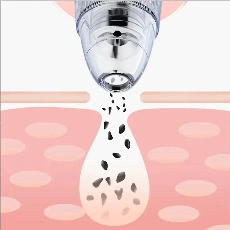 USB Blackhead Remover Electric Vacuum Acne Pimple Black Spot Suction Facial Pore Cleaner Skincare Exfoliating Beauty Instrument 1 USB Blackhead Remover Electric Vacuum Acne Pimple Black Spot Suction Facial Pore Cleaner Skincare Exfoliating Beauty Instrument