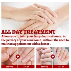 3Pcs Mardi Gras 2024 Oil,relief Oil,Toe Nail Repair Oil For Damaged Nails,paronychia Relief Oil 10ml -Cosmetics Promotion Store 1360030262 max