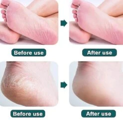 Electric Foot Grinder - Usb Peeling, Dead Skin Repair, Callus Care Device 7 Electric Foot Grinder - Usb Peeling, Dead Skin Repair, Callus Care Device -Cosmetics Promotion Store 1386464456 max