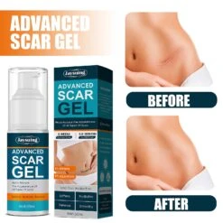 Scar Cream Gel Keloid Removal Repair Scar Cream Removal Scar Marks For Face Or Body