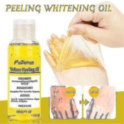 Yellow Peeling Oil Lighten Dark Spots Acne Melanin Skin Bleaching Peeling Oil Color01