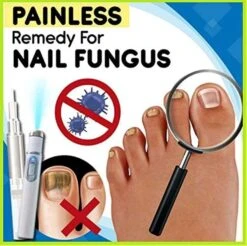 2pcs Anti-fungal Home Treatment Set Toenail Treatment Pen, Onychomycosis Repair Laser And Pen,quick And Visible, Safe And Easy To Use Ggk