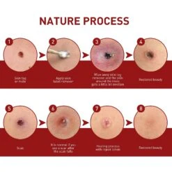 1-3X Organic Tags Solutions Serum - Organic Skin Spot Purifying Serum -organic Skin Tag Solution Serum Remover New 1PC 9 1-3X Organic Tags Solutions Serum - Organic Skin Spot Purifying Serum -organic Skin Tag Solution Serum Remover New 1PC -Cosmetics Promotion Store 1408336401 max