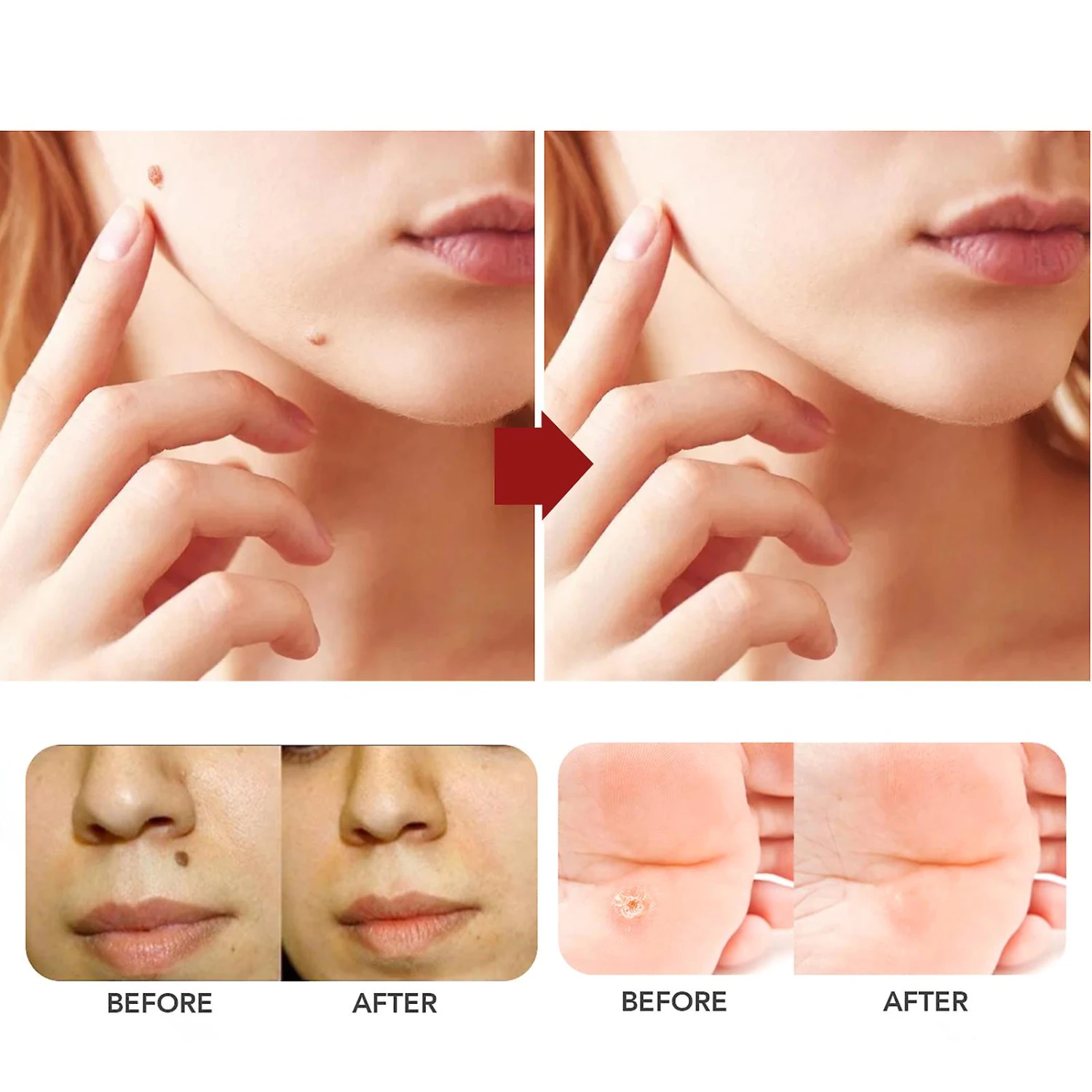 1-3X Organic Tags Solutions Serum - Organic Skin Spot Purifying Serum -organic Skin Tag Solution Serum Remover New 1PC 2 1-3X Organic Tags Solutions Serum - Organic Skin Spot Purifying Serum -organic Skin Tag Solution Serum Remover New 1PC - Image 2