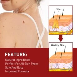 1-3X Organic Tags Solutions Serum - Organic Skin Spot Purifying Serum -organic Skin Tag Solution Serum Remover New 1PC 7 1-3X Organic Tags Solutions Serum - Organic Skin Spot Purifying Serum -organic Skin Tag Solution Serum Remover New 1PC -Cosmetics Promotion Store 1408336418 max