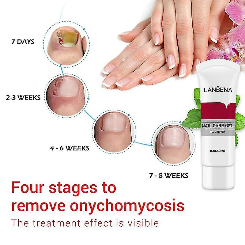 Lanbena Nail Fungus Removal Cream Nail Repair Gel Natural Plant Essence Cream Serum Nail Care Gel Paronychia Onychomycosistslm1 4 Lanbena Nail Fungus Removal Cream Nail Repair Gel Natural Plant Essence Cream Serum Nail Care Gel Paronychia Onychomycosistslm1 - Image 4