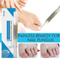 Lanbena Nail Fungus Removal Cream Nail Repair Gel Natural Plant Essence Cream Serum Nail Care Gel Paronychia Onychomycosistslm1