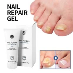 Healio Nail Treatment Gel Nail Care Gel Nail Thickening Nail Brightening Nail -Cosmetics Promotion Store 1427295531 max