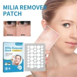 2024 Milia Remover Patches For Milia Spot Wart Oil Bumps Treatment Skin 144Pcs -Cosmetics Promotion Store 1448857693 max