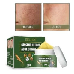 EELHOE Ginseng Herbal Acne Clearing Cream Removes Acne, Repairs Acne Pits, Fades Acne Scars, Gently Moisturizes, Cleanses And Brightens Acne Treatment 1PCS -Cosmetics Promotion Store 1459892724 max