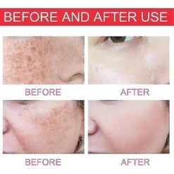 Serum Fade Black Spot Essence Correcting Glow Fading Cream Serum For Dark Spot