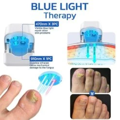 Nail Fungus Laser Device Light Therapy Onychomycosis Toes Treatment Rechargeable