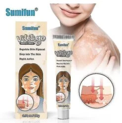 Vitiligo Removal Cream Vitiligo Cleansing Cream Facial Care Ointment Skin Care