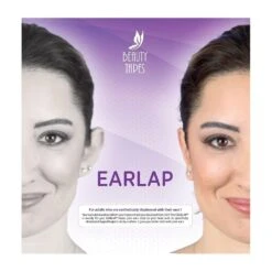 Earlap Cauliflower- Protruding Ear Concealer Corrector (earlap) -Cosmetics Promotion Store 147208032 max