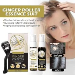 Derma Roller And Hair Growth Serum Kit, Thicken And Strengthen For Hair Regrowth With 0.25MM Derma Roller, Anti Hair Loss Trengthen Hair Roots -Cosmetics Promotion Store 1474534781 max