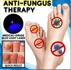 2pcs Anti-fungal Home Treatment Set Toenail Treatment Pen, Onychomycosis Repair Laser And Pen,quick And Visible, Safe And Easy T