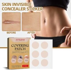 Skin Invisible Concealer Sticker Skin Scar Tattoo Acne Print Cover Sticker Waterproof Skin Color Invisible Sticker