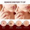 3pcs Tags And Moles Remover Wipeoff Tags& Moles Remove Quick &safe Remove