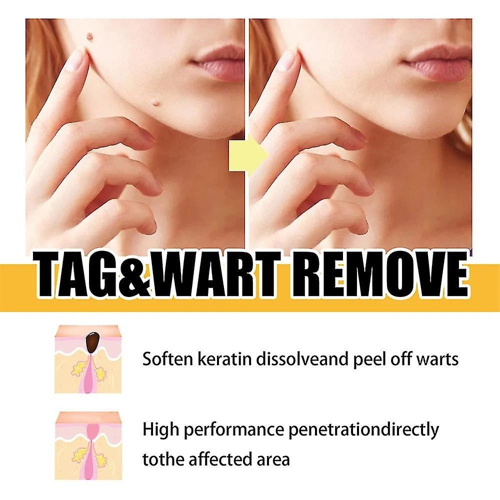 Bee Venom Mole Remover - 3ml Natural Solution For Tags 1 Bee Venom Mole Remover - 3ml Natural Solution For Tags