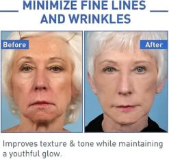 2023 New Youthful Face Serum, Dark Spot Corrector & Collagen Boost 5PCS