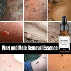 Active Skin Mole Removal Essence - Salicylic Acid Formula For Wart And Mole Removal, Fade Melanin, Improve Dull Skin Tone -Cosmetics Promotion Store 1492556753 max