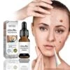 Active Skin Mole Removal Essence - Salicylic Acid Formula For Wart And Mole Removal, Fade Melanin, Improve Dull Skin Tone