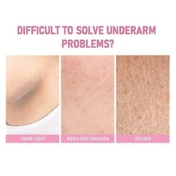 Whitening Cream For Dark Armpits, Skin Lightening Treatment 1pc -Cosmetics Promotion Store 1497499139 max