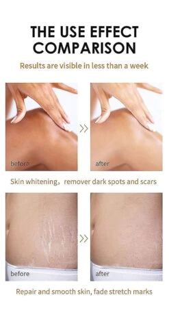 Skin Whitening And Exfoliating - Extra Strength Yellow Peeling Oil -Cosmetics Promotion Store 1497504137 max