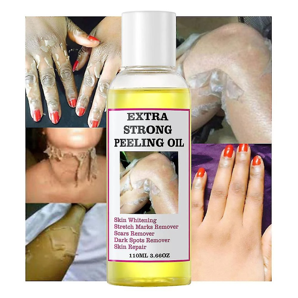 Extra Strength Yellow Peeling Oil - Skin Whitening & Exfoliating For Dark Spots (110ml)n 3PCS 2 Extra Strength Yellow Peeling Oil - Skin Whitening & Exfoliating For Dark Spots (110ml)n 3PCS - Image 2
