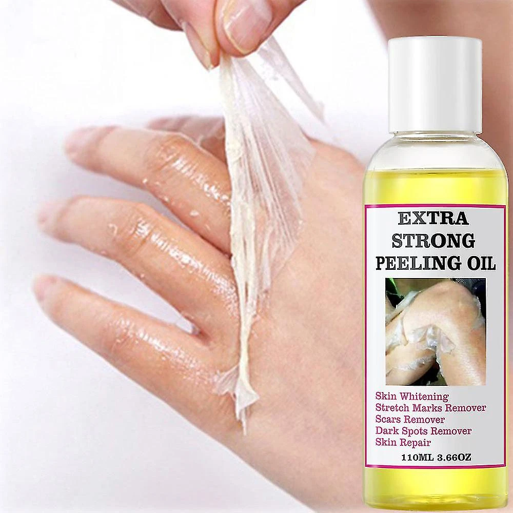 Extra Strength Yellow Peeling Oil - Skin Whitening & Exfoliating For Dark Spots (110ml)n 3PCS 5 Extra Strength Yellow Peeling Oil - Skin Whitening & Exfoliating For Dark Spots (110ml)n 3PCS - Image 5