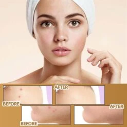 Invisible Concealer Sticker - Skin Scar Tattoo Acne Cover | Waterproof & Skin Color