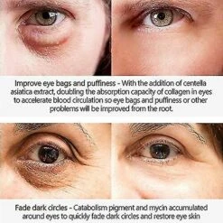 Dark Circle Eye Cream, Reduce Puffiness And Bags Under Eyes, Instant Firming Results, Retinol Eye Treatment 3pcs -Cosmetics Promotion Store 1497724991 max