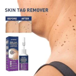 Skin Tag Remover, Skin Tag Remover, Serum From Plant ,extracts For Face And 20ml -a