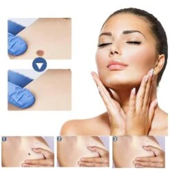 2023 Best Seller- Skin Tag Remover Patches,new & Improved Formulation- Quick Effect Pimple Patches -Cosmetics Promotion Store 1513829341 max